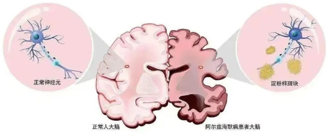 e06cc0f6864e8e7d1177550ac83178c8.png